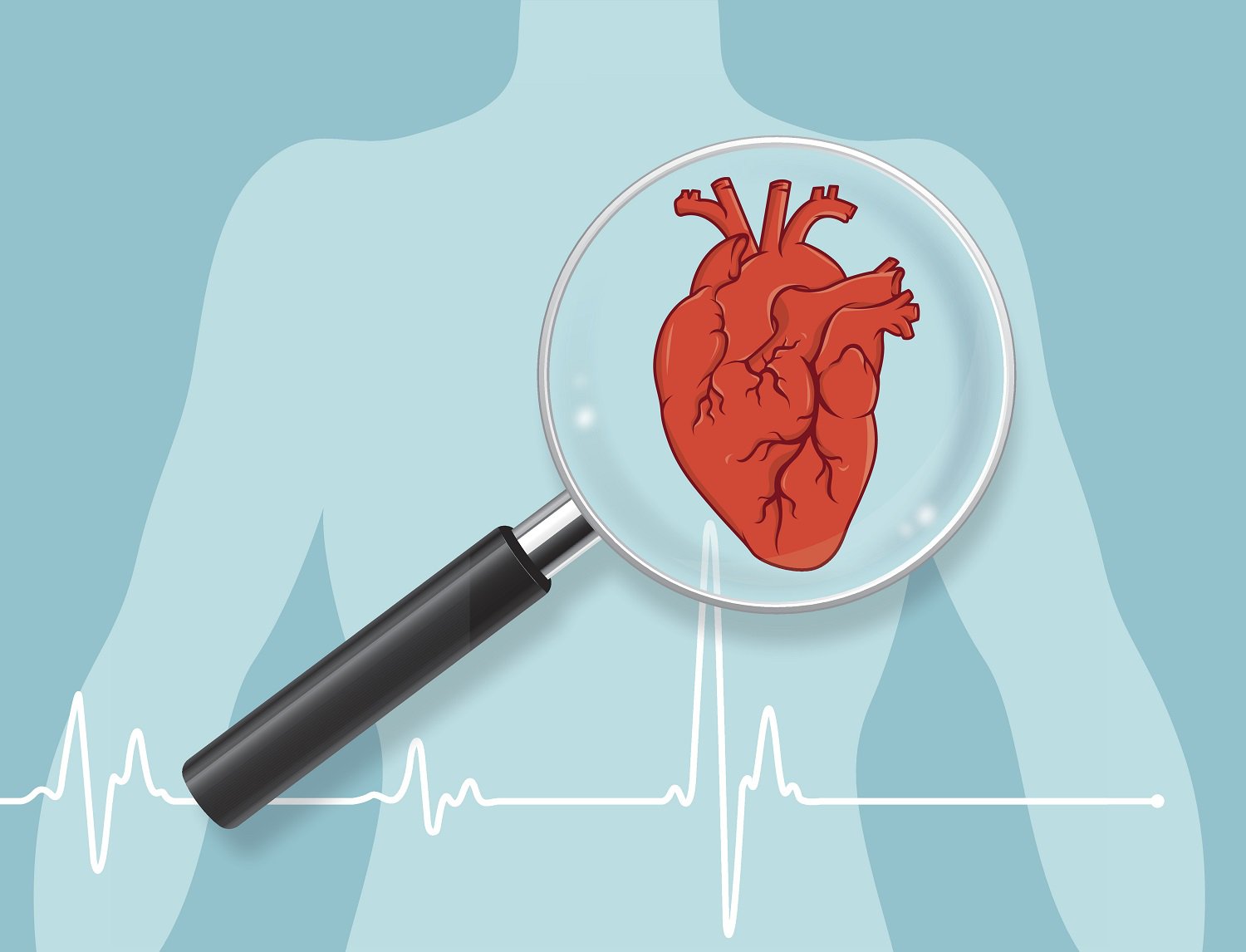 Các nhà khoa học vẫn đang nghiên cứu tại sao người hồi phục sau Covid-19 bị tổn thương tim