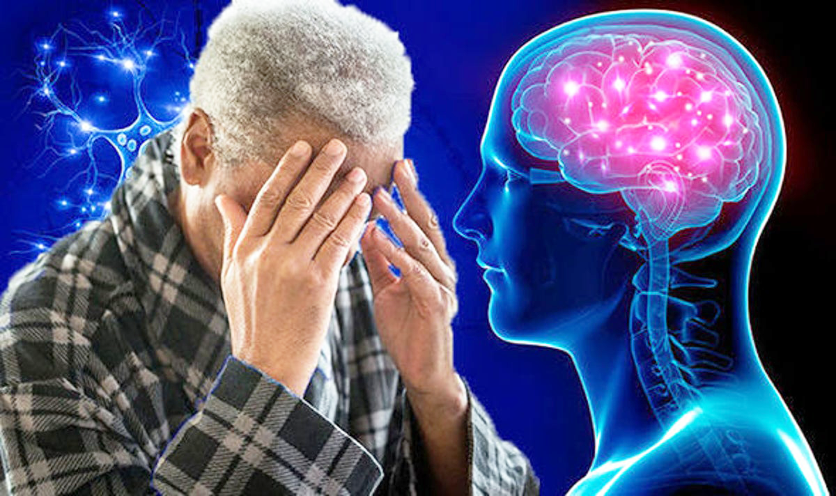 Các nghiên cứu về thuốc Bumetanide điều trị bệnh Alzheimer